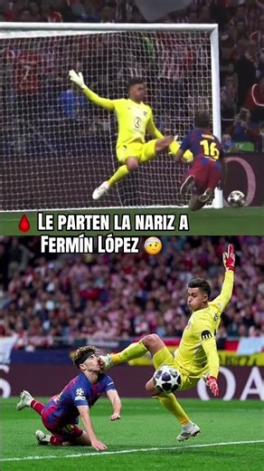 What a blow; Fermín López is injured after a kick to the face from goalkeeper Musso 🤕🩸