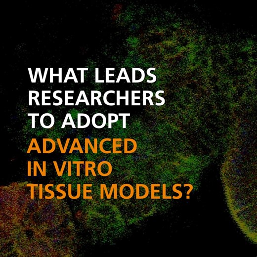 Drug discovery can feel like navigating through a maze, but the right models can help guide you to breakthrough solutions faster. ⏩ Learn how stem cell-based, 3D systems are accelerating research in this interview with Dr. Bas Trietsch from MIMETAS: https://bit.ly/3MIXjAD | STEMCELL Technologies | Facebook