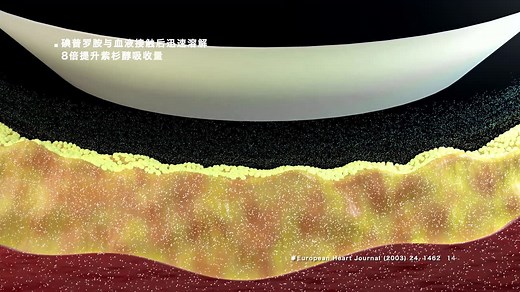 Reewam PTX药物球囊扩张导管演示