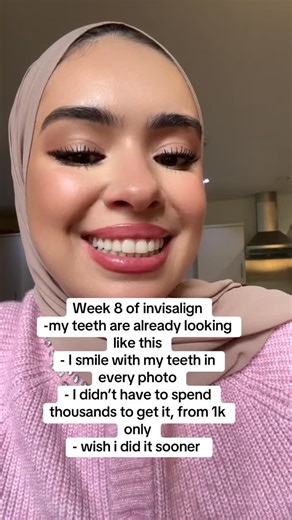 🚨 THIS IS NOT A DRILL!! OUR BIGGEST INVISLIGN SALE THIS BLACK FRIDAY🚨 GUYS DON’T MISS OUT!! For the first 50 patients this month Today you can start Invisalign from £30!! FREE whitening, see your smile before you start AND every case is specialist orthodontist approved 🤩 THE BEST BLACK FRIDAY DEAL GUARANTEED FOR INVISALIGN 👊🏻💥 I’m doing this as I am ranked the number 1 Invisalign provider in the UK & Europe 🔥 Super excited for you guys!! THE LOWEST INVISALIGN PRICE GUARANTEED 🤩 📍 London