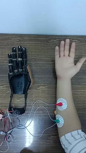 Bionic Hand Prototyping with STM32 and Arduino