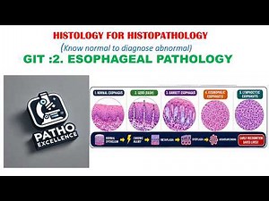 GIT Histology for Histopathology Ep 2: Esophageal Pathology | GERD, Barrett & Cancer
