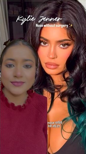 Nose Surgery | Nose shaper kaise banaye | Nose surgery before after | Nose Contour #nosecontouring