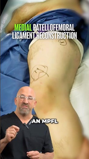 What Happens When Your Kneecap Pops Out?