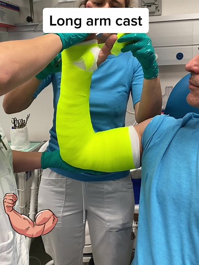 How to Apply a Long Arm Cast | Fiberglass Nursing Tips