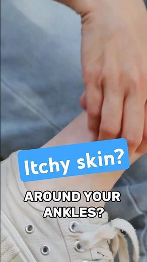 Itchy skin around your ankles vs varicose veins