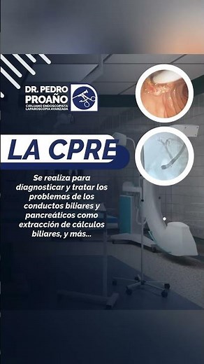 ¿Para qué se realiza una CPRE? (Colangiopancreatografía Retrógrada Endoscópica)