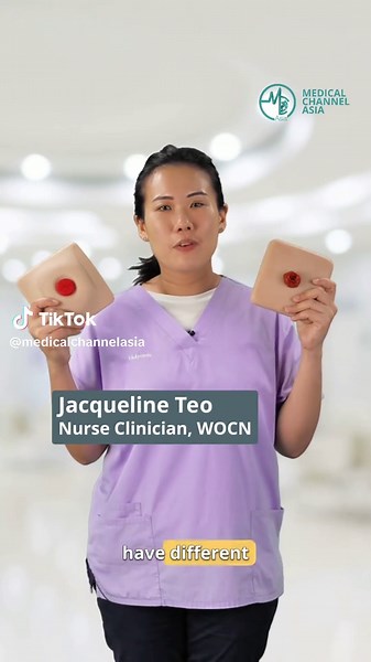 Essential Tips for Effective Stoma Care