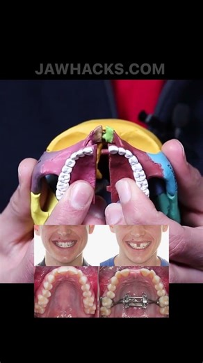 JawHacks Expains How MSE Works (2019)