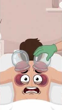 Cupping Therapy Explained: Benefits, Marks & Science | Medical Animation 🔥