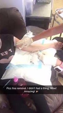 Picc Line Removal