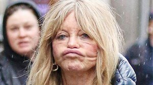 94K views · 293 reactions | Celebrities That Got Insanely Botched After Plastic Surgery | Inform Overload | Facebook