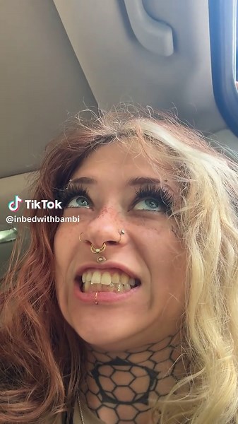 Recovering from a Non-Concussive Head Injury