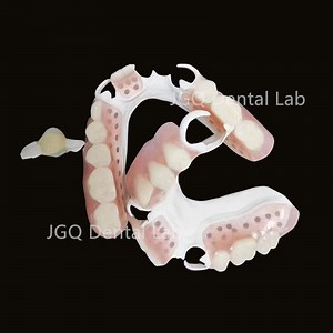 [Hot Item] Biodentaplast Partial Dentures Flexible Plastic Removable Denture Partial Hpp Framework with Acrylic Composite Teeth