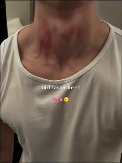Understanding Love Bites and Their Meaning
