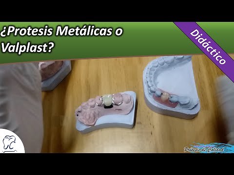 Didáctico 21 - ¿Prótesis Metalicas o Valplast?