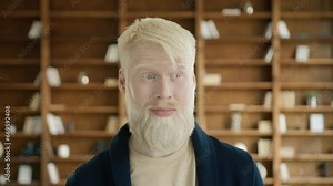 Closeup surprised face of albino man in the office. Blond guy moving eyes actively. Young businessman raising eyebrows. Portrait of blond guy making grimaces. Shocked face expression, slow motion