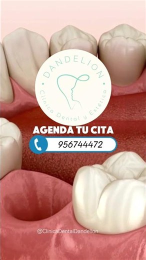 ¿Cuándo es necesario extraer un diente? 🤕