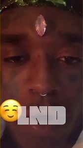 6.5K views · 63 reactions | Lil Uzi Vert Shows Off his $24 Million Dollar Pink Diamond Implant; Face Swollen Due to Implant | Live N' Direct Hip Hop | Facebook