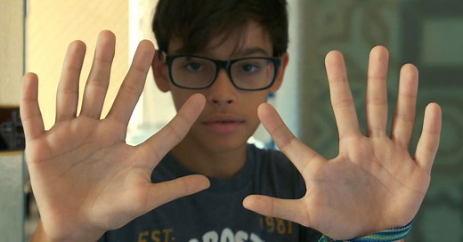 Meet the De Silva family – a 14-member clan all with six fingers and six toes