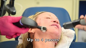 fractional CO2 laser vs plasma resurfacing demo