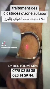 136 reactions · 35 comments | Traitement des...