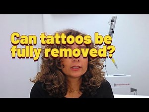 I Remove Tattoos for a Living… Here’s the Truth