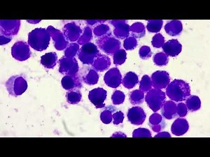 Mast cell tumour overview and cytology