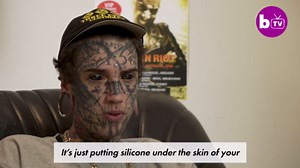 22-year-old tattoo addict got his eyeballs inked