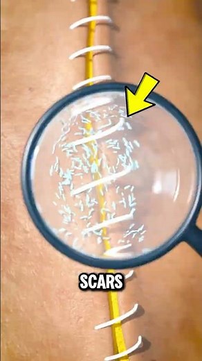 How Scars Actually Happen