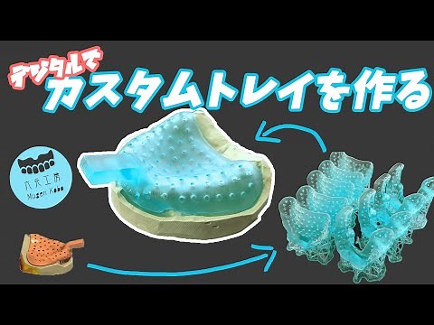 【歯科技工】個人トレイを作ったから見てほしい