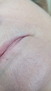 The power of the blush 😍 Subtle colour but what a difference to the shape! Swelling is normal straight after treatment, no filler was used 🤪 Happy client 🤩 Book now for Feb 26 Livvy x | Microblading with Livvy M