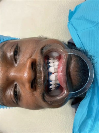 Brighten Your Smile with Teeth Whitening Services