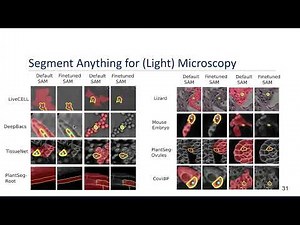 VIA Webinar: Segment Anything for Microscopy with Prof. Constantin Pape
