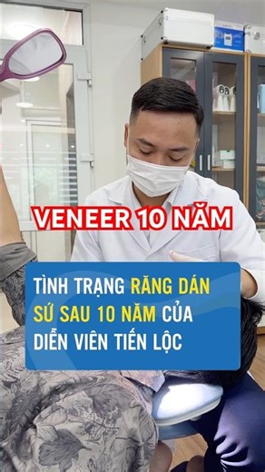 10 NĂM DÁN VENEER — Răng Diễn Viên Tiến Lộc Bây Giờ Ra Sao?