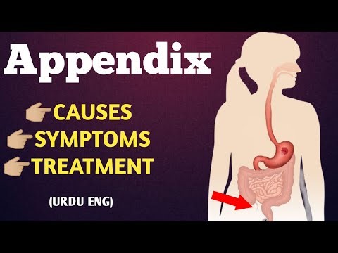 Appendix cause, symptoms ،treatment
