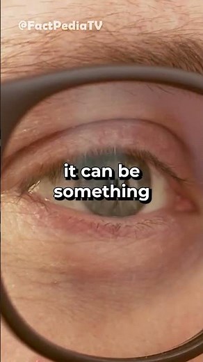 👁️‍🗨️ The Surprising World of Hallucinations in Blindness! 😱