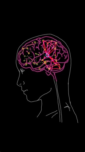 Exploding Head Syndrome 😵