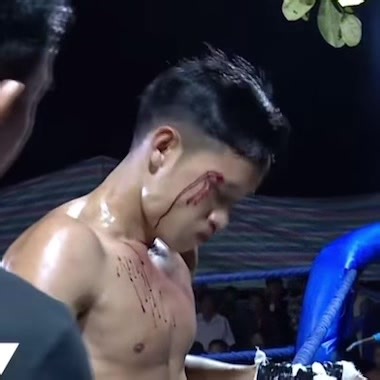 သန့်ဇင်နာမည်မကြီးခင်တုန်းက 3MA ရဲ့ မိခင်ကုမ္မဏီ ANS ရိုးရာလက်ဝှေ့ပွဲမှာ ရန်တိုငိးကျော်နဲ့ပွဲရဲ့ရုပ်သံပါ။ ကျနော်တို့က ကျင့်ပတဲ့ပွဲများရဲ့ရုပ်သံများကို စနစ်တကျရိုက်ကူးသိမ်းဆည်းထားခြင်းကြောင့် နောက် ၁၀ စုနှစ်ကြာသည်ဖြစ်စေ ပရိတ်သတ်များအား ထုတ်လွှင့်ပြသပေးနိုင်သဖြင့် 3MA, ANS ပွဲများပါဝင်ယှဉ်ပြိုင်ကစားခဲ့ပါက သေချာပြင်ဆင်ထားဖို့လိုအပ်ပါတယ်။ Video မူပိုင် - ANS This video is owned by ANS BOXING STUDIO CO., LTD, Parent company of 3MA #3MA #ANS