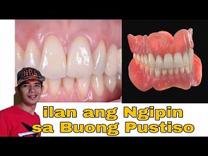 Ilan ang Ngipin ng Buong Pustiso at ilan ang natural na ngipin ng tao. denture teeth.