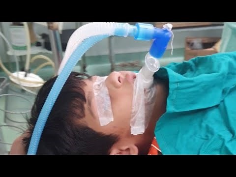6 years old boy undergoing urethroplasty under General anesthesia