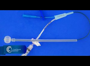 Balonlu HSG Kateteri