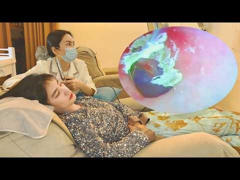 ASMR Visual Ear Cleaning for Deep Sleep 🎧 No Talking