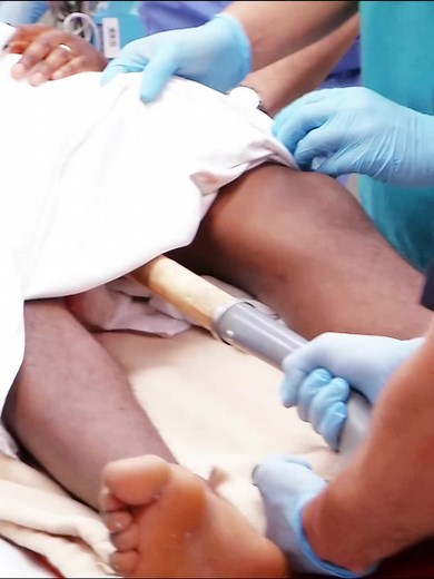 ER Doctor's Shock: Shovel Impalement Horror Story