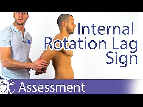 Internal Rotation Lag Sign | Subscapularis Tear
