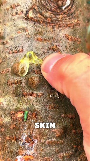 World's Most Dangerous Tree