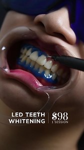 6.7K views · 42 reactions | ❣️ BACK BY POPULAR DEMAND! ❣️ 醴 Whiten...