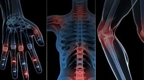 Addressing Rheumatic Diseases: Diagnostic and Treatment Updates