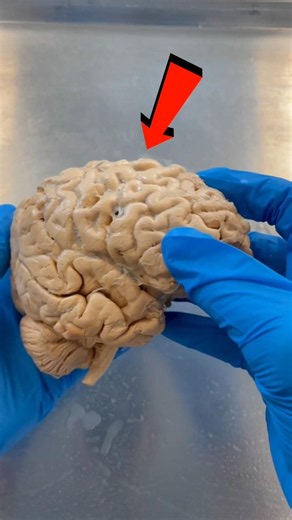 😱 Animal Brain Compare!.. Don't skip