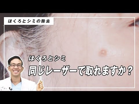 【初心者向け】シミとほくろはほぼ同じ？専門医が徹底解説！